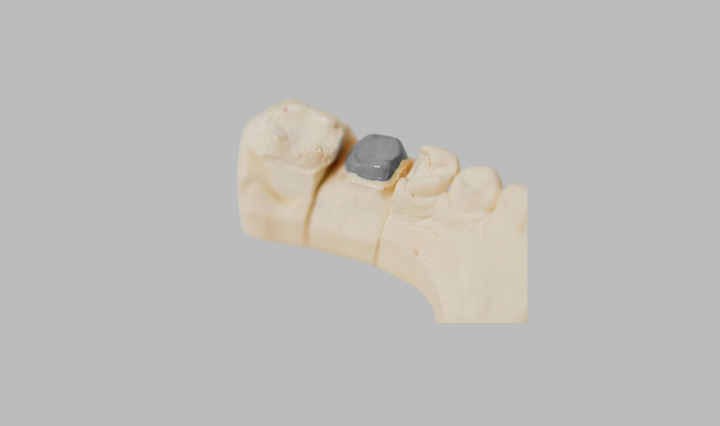 Teeth Filling