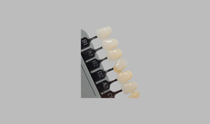 Teeth Whitening